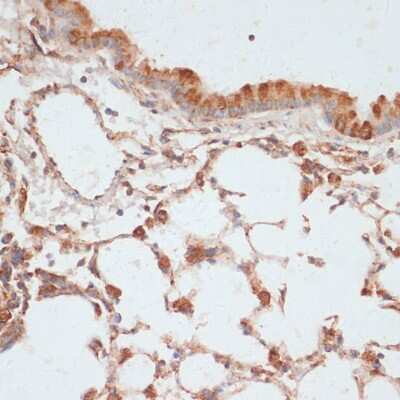 Immunohistochemistry-Paraffin: VASP [p Ser155] Antibody - Azide and BSA Free [NBP3-05448]